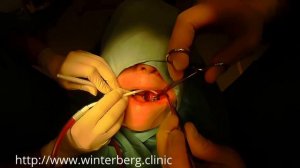 Удаление зуба мудрости