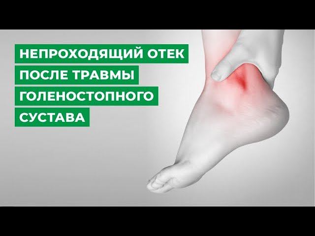 Непроходящий отек после травмы голеностопного сустава