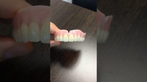 Немецкий полный съемный протез с силиконом