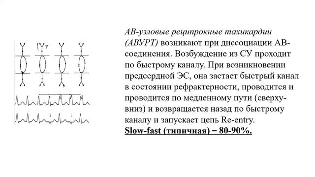 (2023.04.05) Пак Наталья Лероновна - ЭКГ. Нарушения ритма сердца. смотреть онлайн