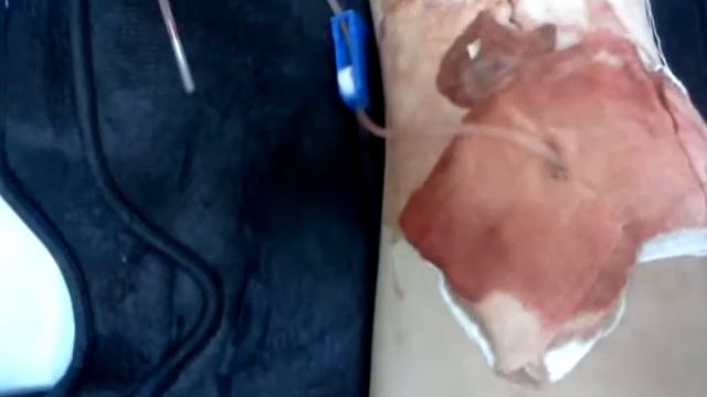 Моя коленка :-) смотреть онлайн