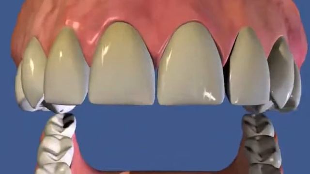 Як користуватися зубною ниткою смотреть онлайн