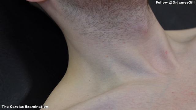 The Cardiac Examination - Clinical Skills - Dr James Gill