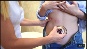 Вакуумный массажный аппарат №1 Glavzdrav (360p)