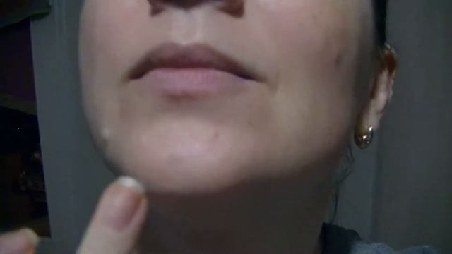 Прыщ? Зубная паста поможет! смотреть онлайн
