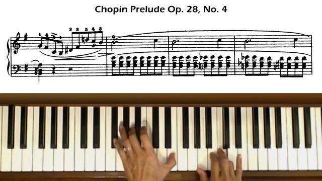 Chopin Prelude Op. 28, No. 4 in E Minor смотреть онлайн
