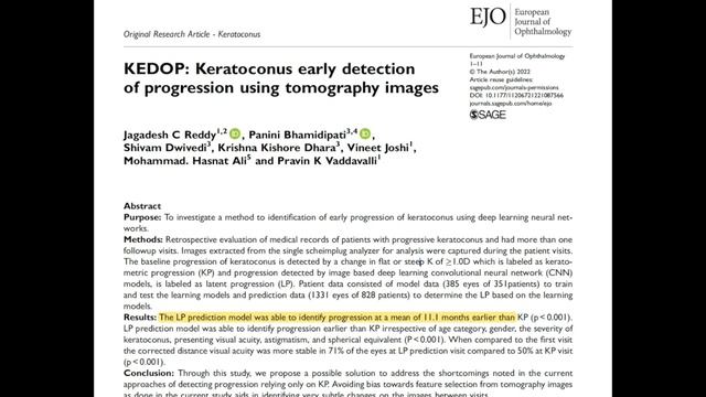 What is Keratoconus?#ophthalmology #vision #keratoconus #contactlenses #children #rubbing смотреть онлайн