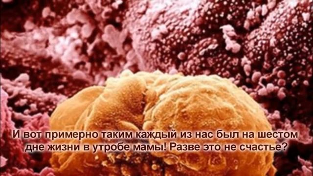 Познай себя: 15 захватывающих фото человеческих органов под микроскопом! смотреть онлайн