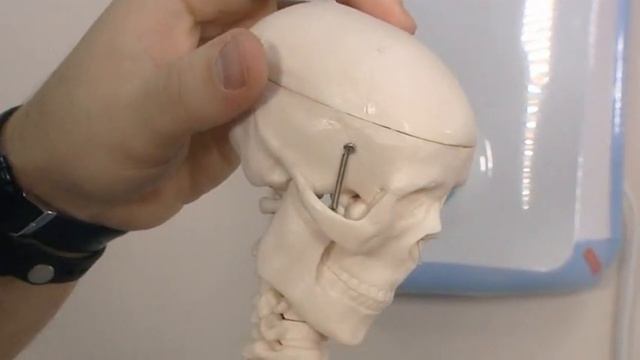 Что делать при вывихе челюсти? смотреть онлайн