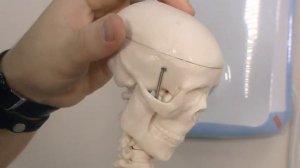 Что делать при вывихе челюсти?