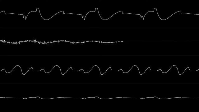 Chicken Invaders 2: The Next Wave Soundtrack - Oscilloscope View смотреть онлайн