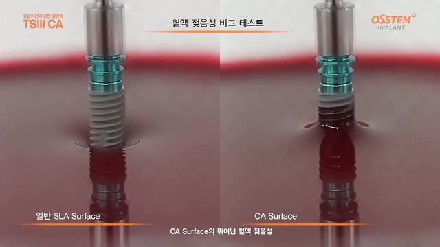 Презентация имплантатов Osstem Implant TSIII CA смотреть онлайн