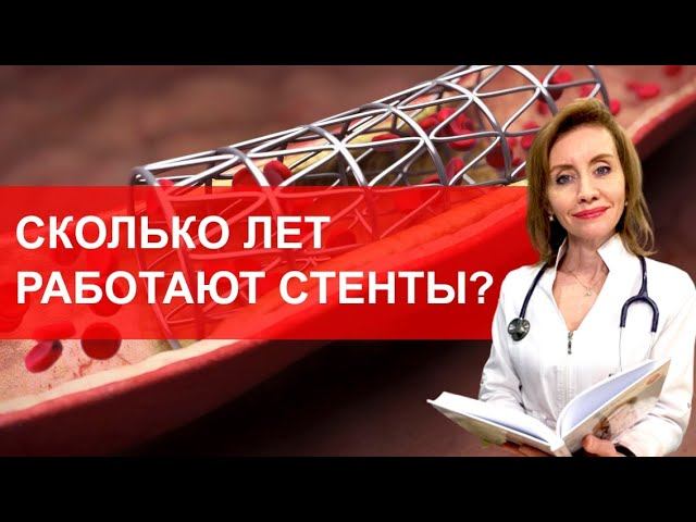 Сколько лет работают стенты? смотреть онлайн