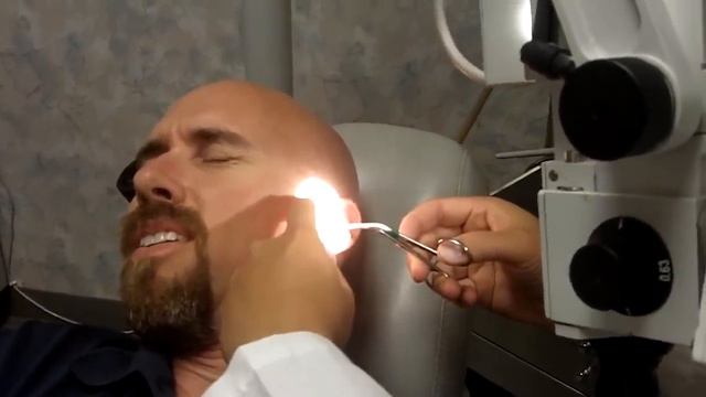 June Bug In My Ear Removal and Freak out! As seen on So You Think You'd Survive смотреть онлайн