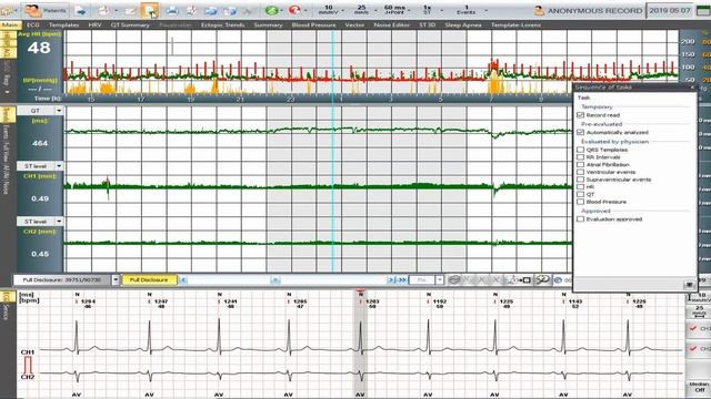 Labtech Hungary Video 1 First steps Evaluation of Holter record смотреть онлайн
