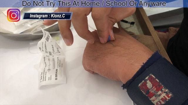 What Is Hemophilia And How It Is Treated  - Kionz Vlog