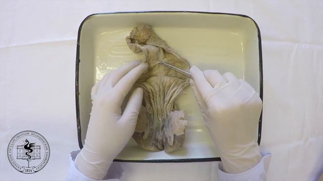 Спланхнология, анатомия прямой кишки смотреть онлайн