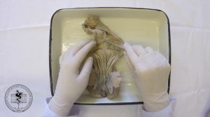 Спланхнология, анатомия прямой кишки