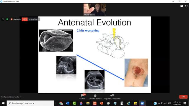 Pediatric week día 2 5 смотреть онлайн