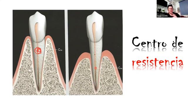 Microimplantes en Ortodoncia Dr. Sergio Castillo смотреть онлайн