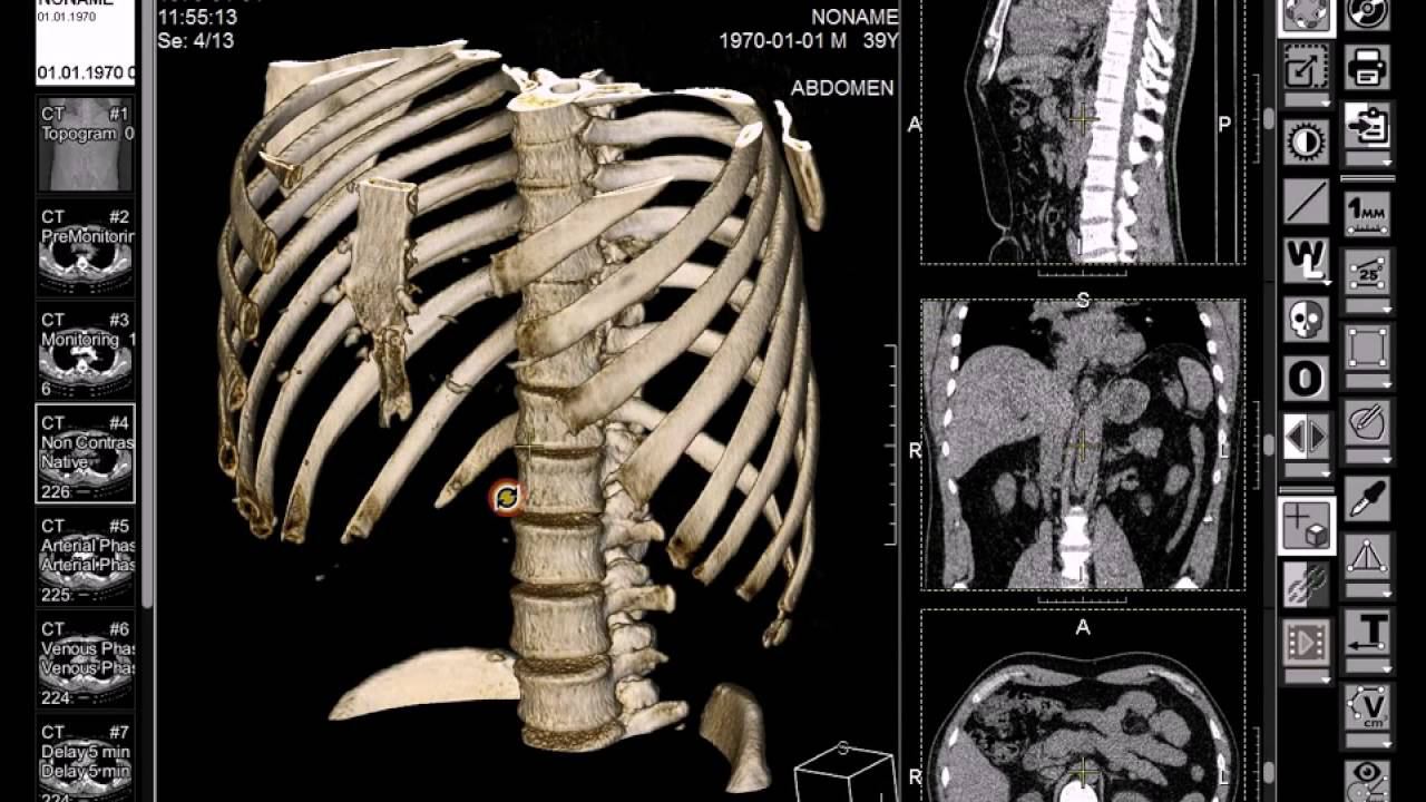 ct смотреть онлайн