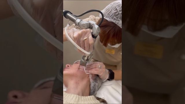 Клиника VALLISTEP Кострома ЛАЗЕРНАЯ ШЛИФОВКА ЗОНЫ ЩЁК смотреть онлайн