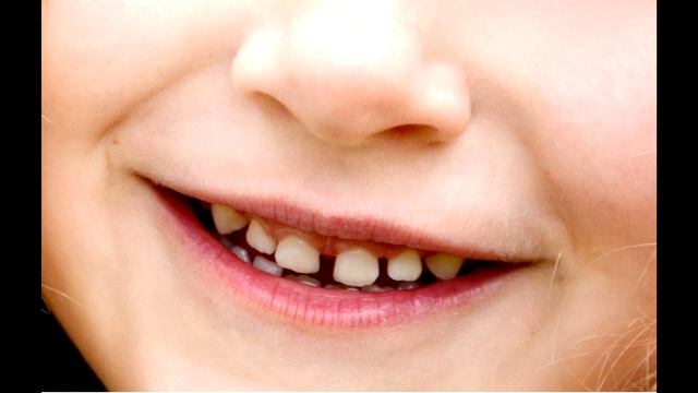 Прогрессивная мышечная релаксация для детей. Сказка «Нет больше плохого настроения!» смотреть онлайн