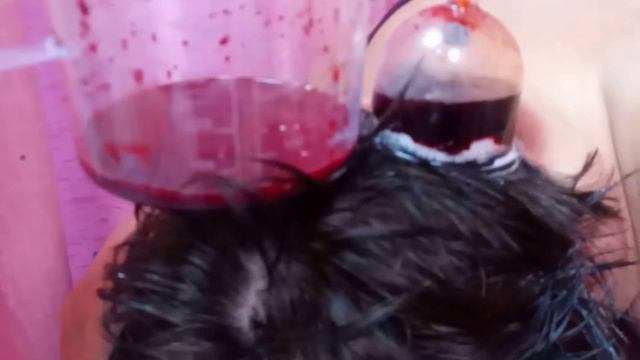 Кровопускание Головы Лечение 15 летней  головной боли Кровь разного цвета с одной головы