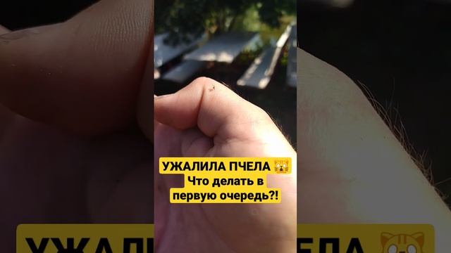ПЧЕЛИНОЕ ЖАЛО! Как извлекать?! смотреть онлайн