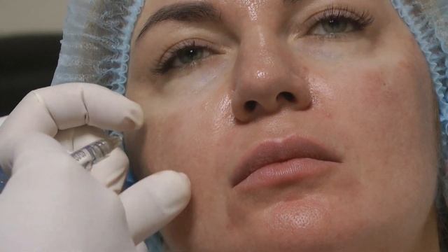 Контурная пластика средней и нижней трети лица. Воркшоп Dr.Valeriy Potiy смотреть онлайн