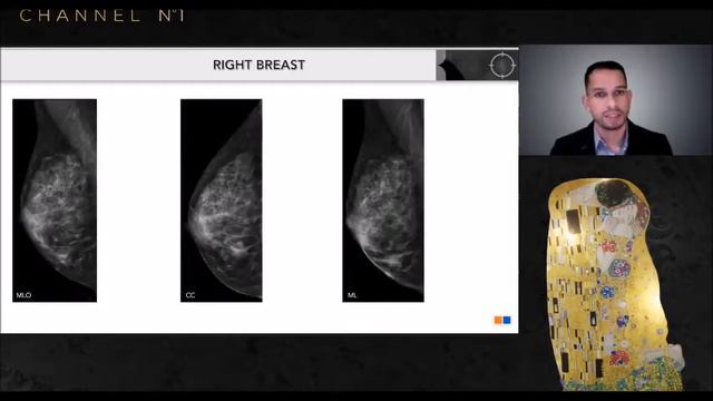 See and biopsy what matters: CESM biopsy for a faster diagnostic process смотреть онлайн