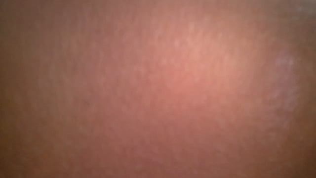 Меня укусила оса!!!! смотреть онлайн