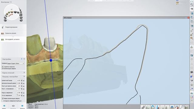 3Shape тренинг смотреть онлайн