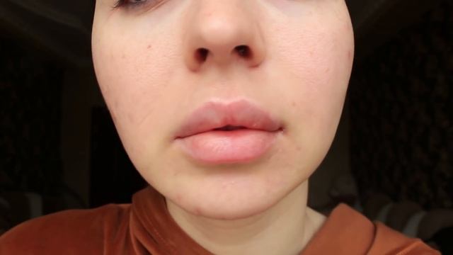 НЕ ПРИНИМАЙ РОАККУТАН, НЕ ПОСМОТРЕВ ЭТО ВИДЕО / ЛЕЧЕНИЕ АКНЕ / Ayka Emilly смотреть онлайн