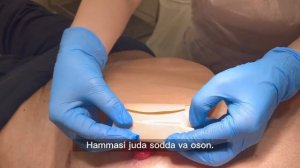 Кишечная стома. Часть 2. Уход за колостомой. Stoma care. Part 2. Colostomy