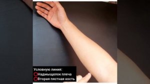 Болит предплечье/немеет рука/Доктор Пак