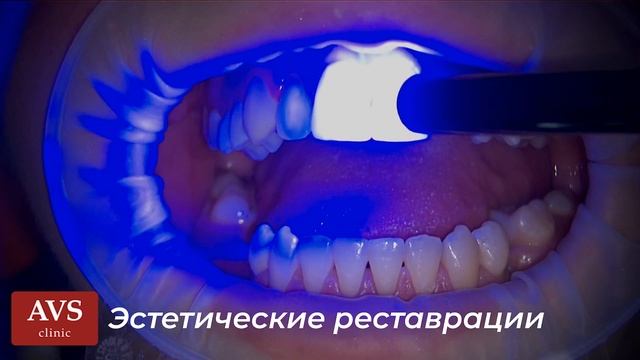 Процесс реставрации.mp4 смотреть онлайн