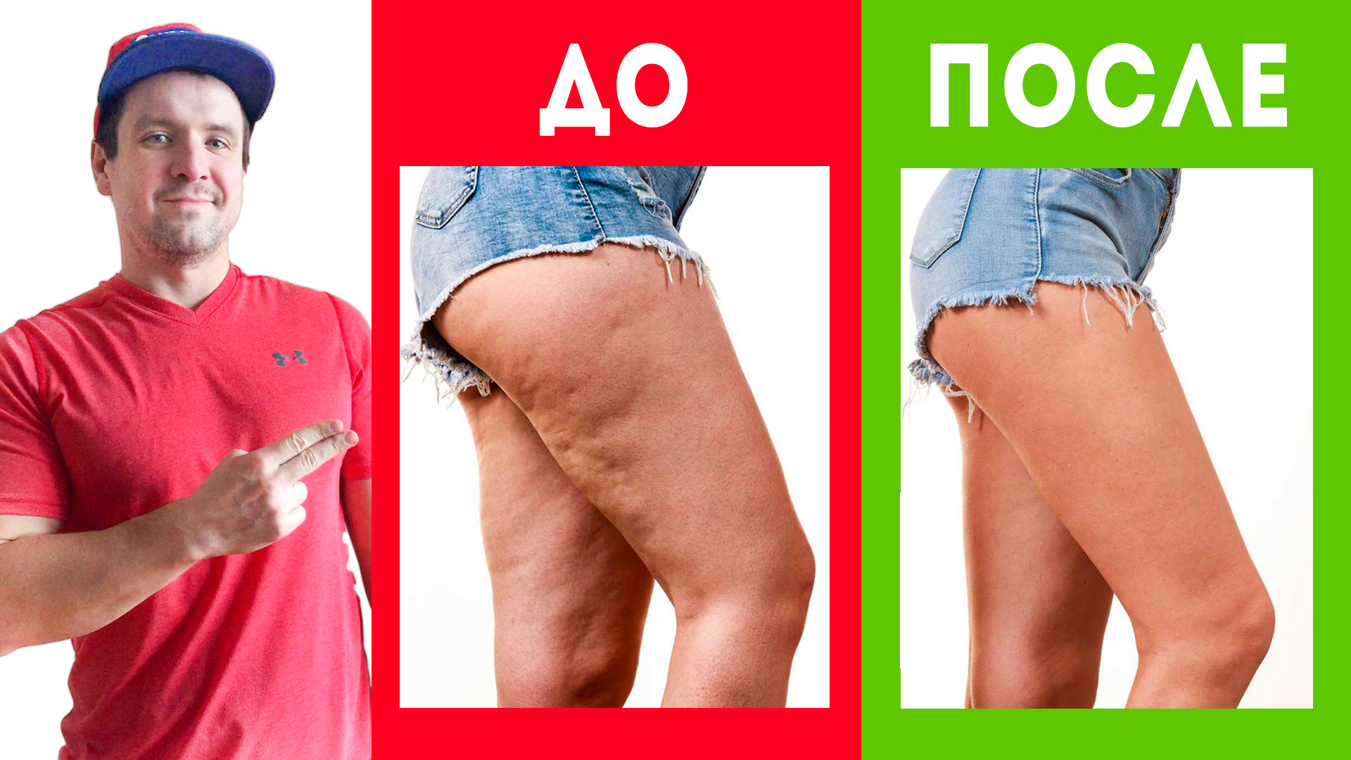 Как избавиться и убрать целлюлит на ягодицах, ляшках, ногах и попе. 3 упражнения в домашних условиях смотреть онлайн