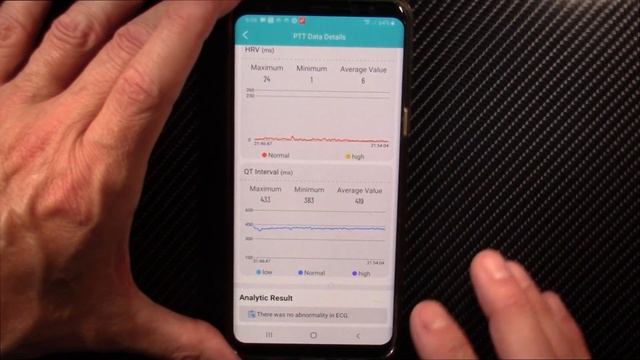 E610 Blood Glucose Smartwatch review | Non-invasive glucose monitoring smartwatch | Health & fitnes смотреть онлайн