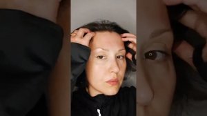 ТЕЙПИРОВАНИЕ ЛБА