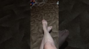 Перелом пяточной кости