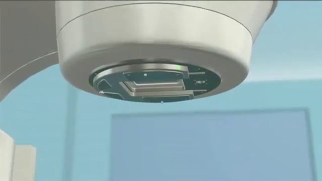 Лучевая терапия IMRT смотреть онлайн