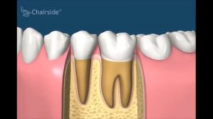 Лечение пульпита зуба в стоматологии АРТ Дент+