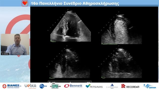D. Klettas | Stress echo for CAD. Cases смотреть онлайн