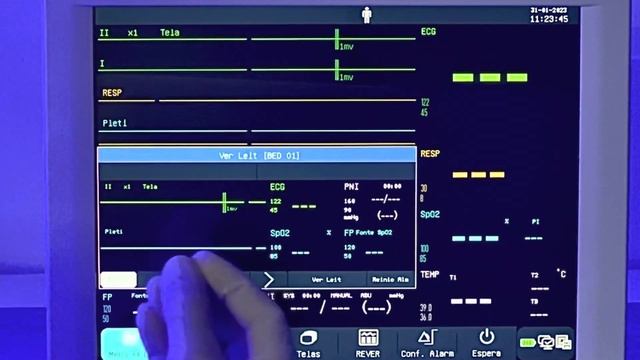 COMEN Monitor Multiparametrico STAR8000F смотреть онлайн