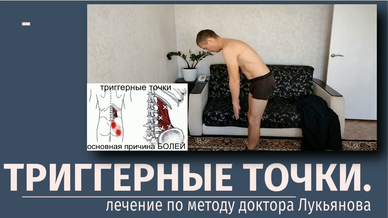 Триггерные точки. Лечение по методу доктора Лукьянова. г.Барнаул.