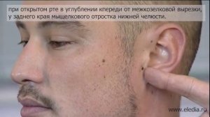 Кровотечение из уха