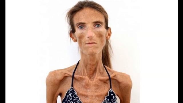 ТОП 5 САМЫХ ХУДЫХ ЖЕНЩИН В МИРЕ HD смотреть онлайн