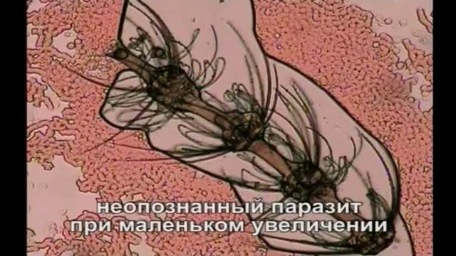 Алексей Водовозов – «13 признаков развода на диагноз» смотреть онлайн