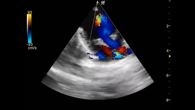 Новорожденный смотреть онлайн